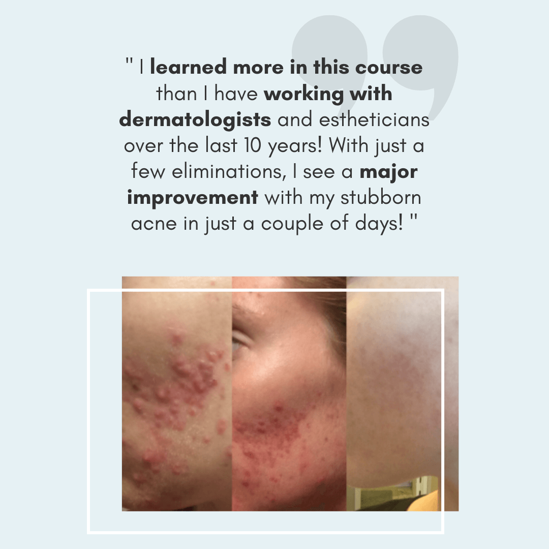 photos of a woman's face with acne before and after clearstem skincare products
